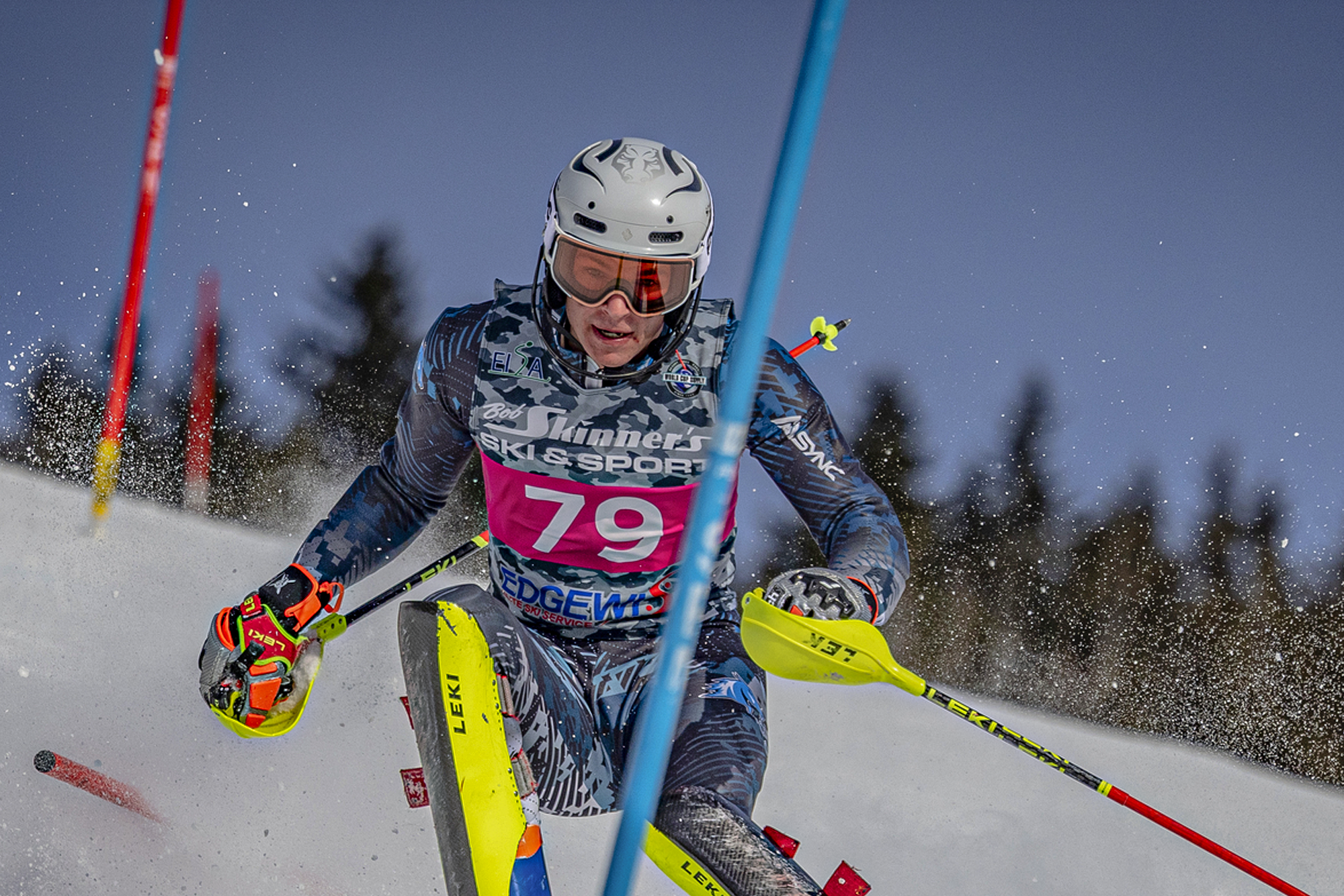 MALPINE STORY 2.9.26