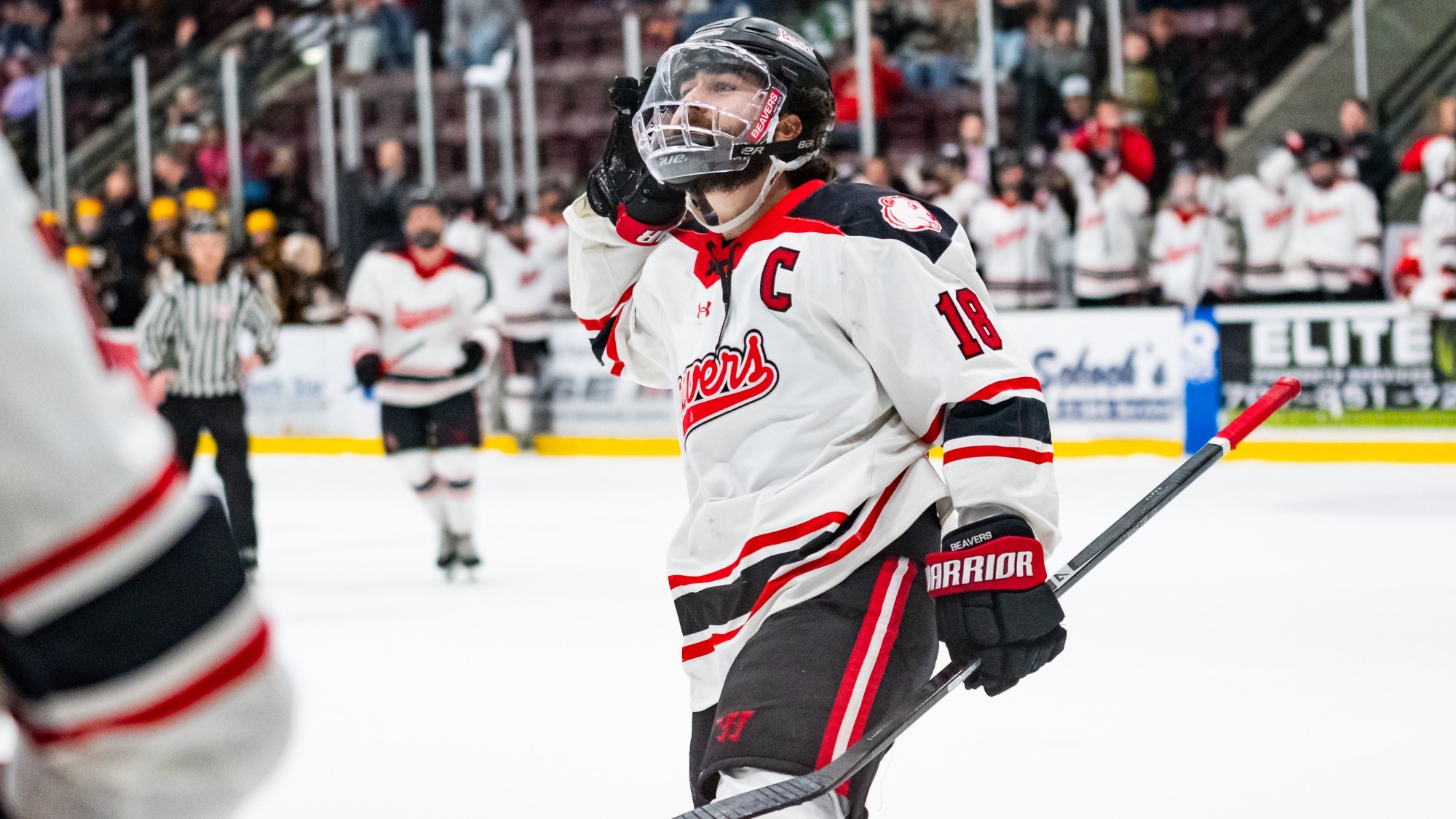 Jay Buchholz vs Calvin